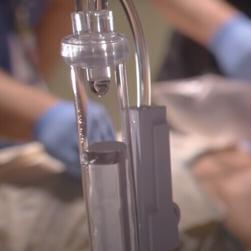 Детоксикация в клинике Стармед Медицинская капельница